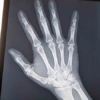 Thumbnail of related posts 016